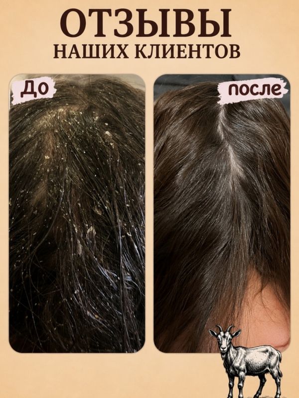 Твердый шампунь ММ • себорея • псориаз • зуд