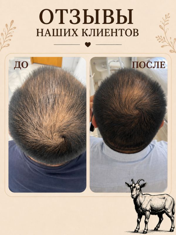 Твердый шампунь • выпадение • перхоть • зуд