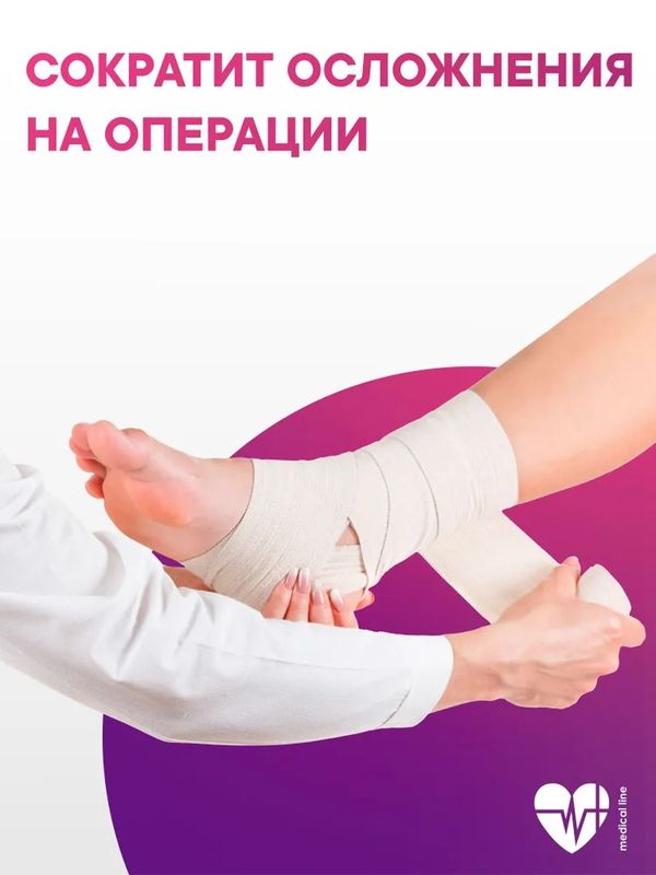 Эластичный Бинт- Компрессионный - Фиксирующий - Интекс Лайт Средняя Растяжимость