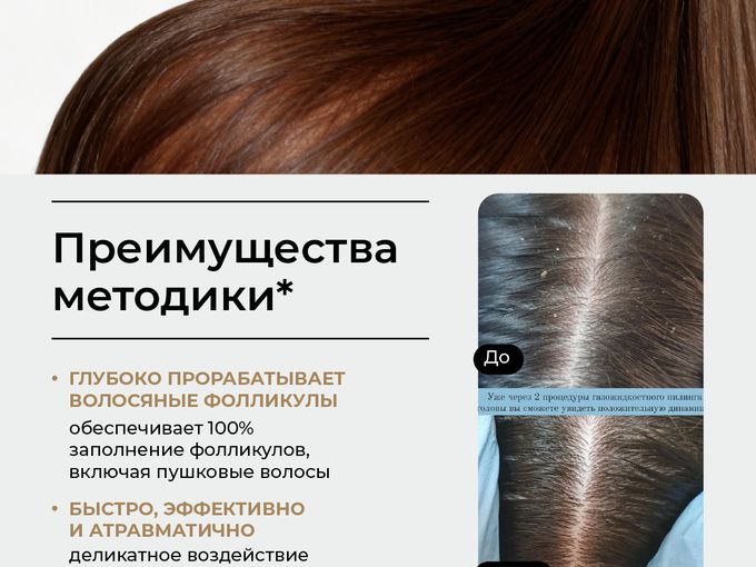 Путь к густым волосам вместе со SkinHale