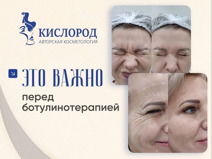 💫 БОТУЛИНОТЕРАПИЯ: ЧТО ВАЖНО ЗНАТЬ?