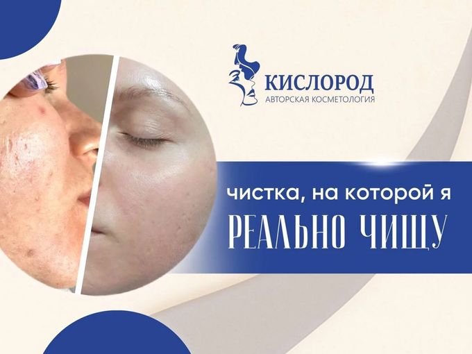 ЧИСТКА, НА КОТОРОЙ Я РЕАЛЬНО ЧИЩУ 😉
