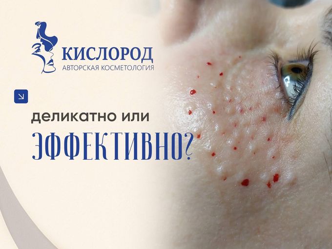 ДЕЛИКАТНО ИЛИ ЭФФЕКТИВНО❓
