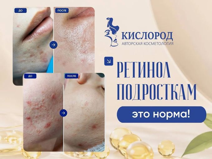 РЕТИНОЛ ПОДРОСТКАМ — ЭТО НОРМА☝️