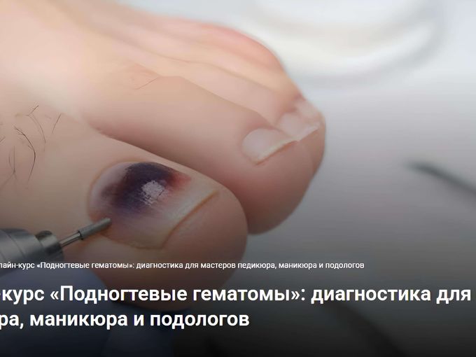Онлайн-курс «Подногтевые гематомы»