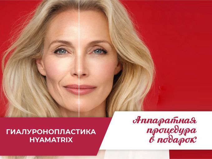 Гиалуронопластика за 6500 рублей + 🎁