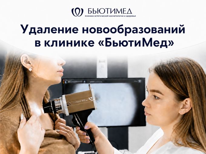 Удаление новообразований в «БьютиМед»