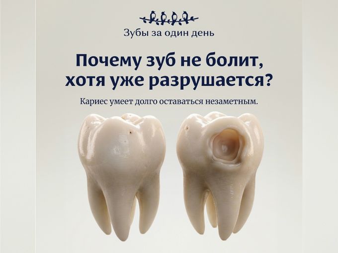 О ЧЕМ "МОЛЧИТ" КАРИЕС?