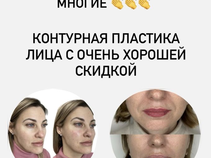 🔥🔥Долгожданная АКЦИЯ 🔥🔥