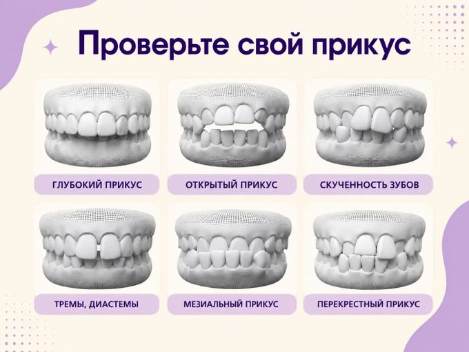 Ваш прикус точно не на этой картинке?