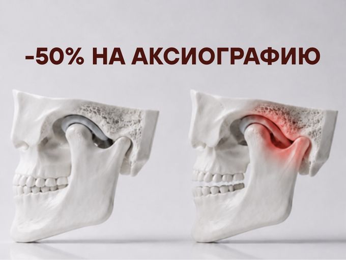 50% на аксиографию