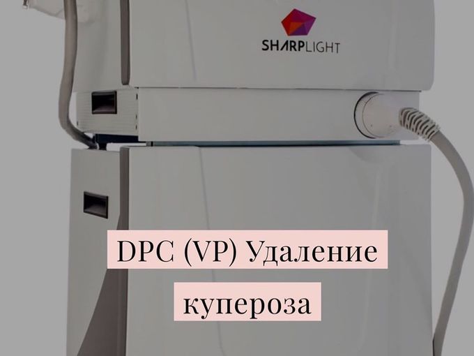 Купероз❗️Розацея ❗️Сосудистые звездочки