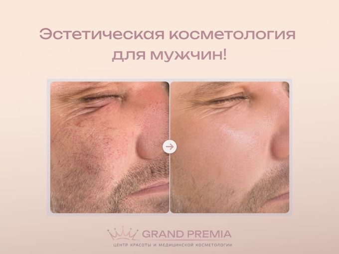 ☝ Мужчинам к прочтению!