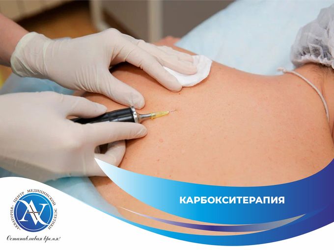 Карбокситерапия: молодо и упруго! 💨 ✨