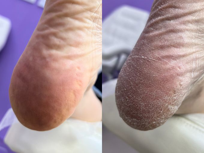 🤯Курс «Дисковый педикюр» за 4.400