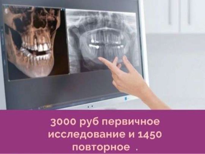 Компьютерная томография зубов🖥️