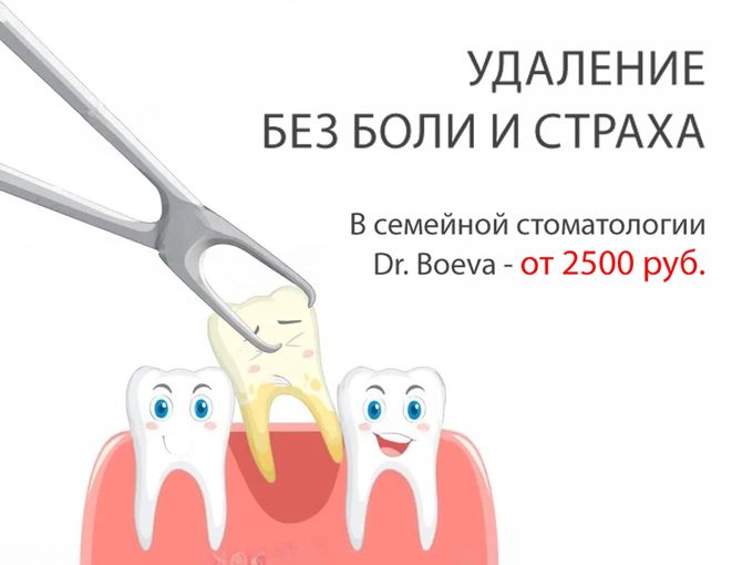 Удаление без боли и страха