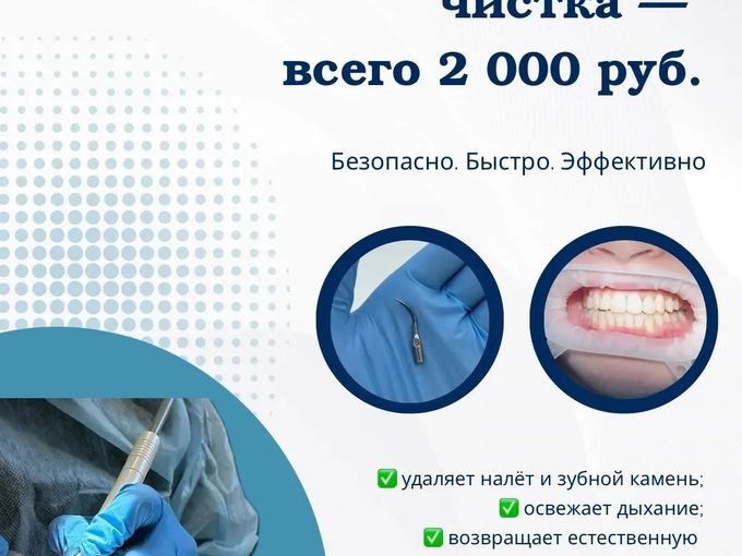 Ультразвуковая чистка зубов 2000 рублей