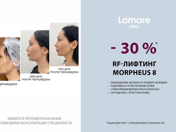 Специальное предложение Morpheus 8-30%!
