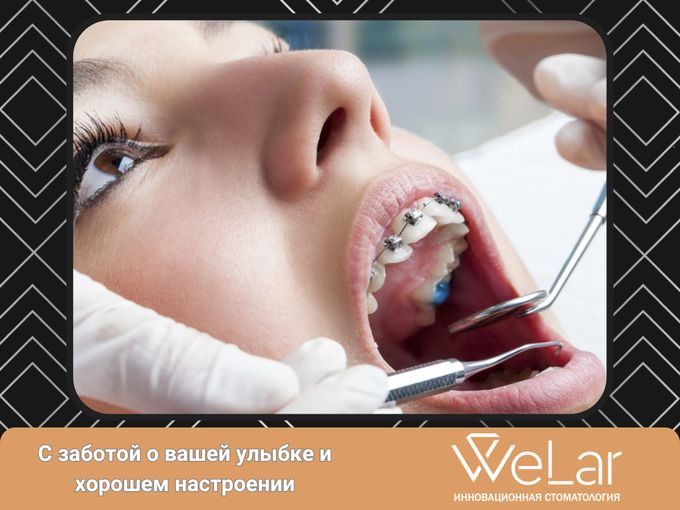 Красивая улыбка — это просто! 🦷✨