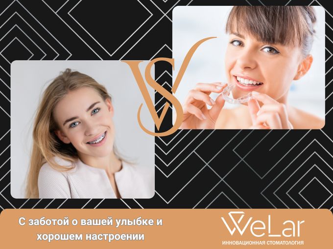 ✨Идеальная улыбка: Элайнеры или брекеты?