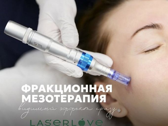 НОВИНКА - фракционная мезотерапия