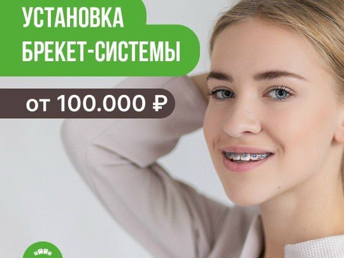 Брекет -система от 100.000 руб 🥳