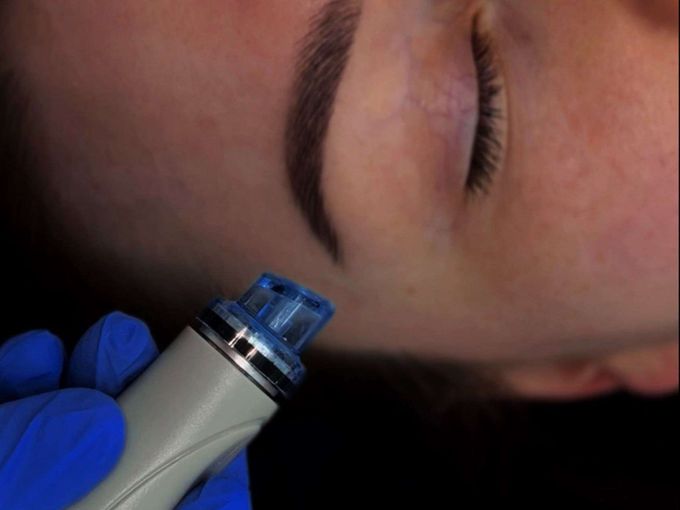 Откройте секрет HydraFacial! ✨