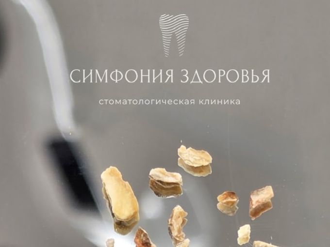 НЕ ДАЙТЕ НАЛЁТУ ПРЕВРАТИТЬСЯ В "КАМЕНЬ"