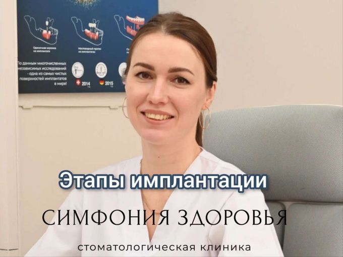 ЭТАПЫ ИМПЛАНТАЦИИ с Кононовой Н.В.