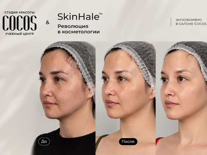 ✨ ОМОЛОЖЕНИЕ БЕЗ УКОЛОВ - В COCOS