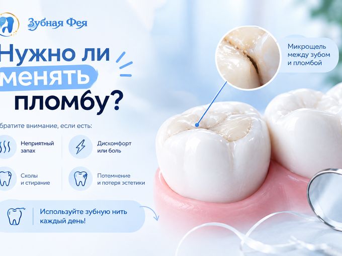 Нужно ли менять старые пломбы?
