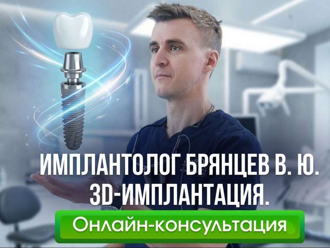 Онлайн-консультация с имплантологом