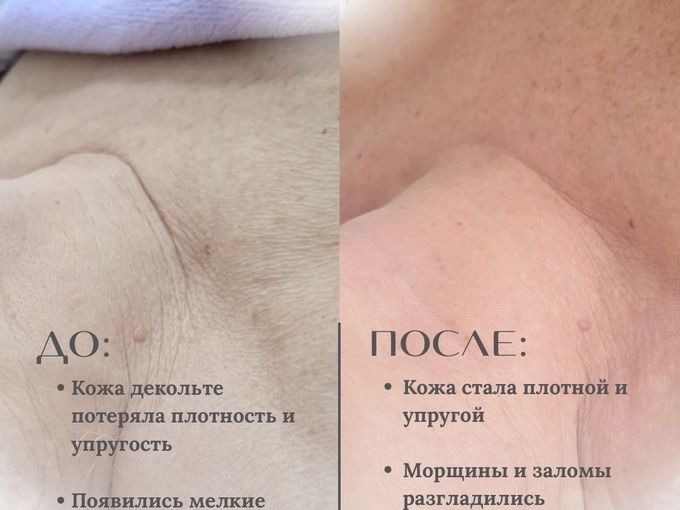 КАК ПОМОЛОДЕТЬ НА 5 ЛЕТ...