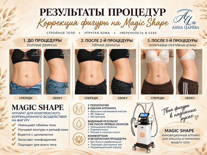 Тело твоей мечты