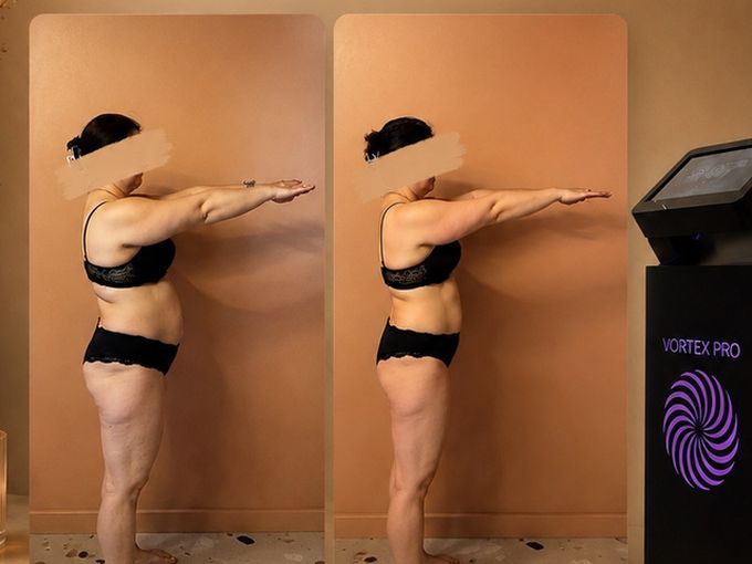 3D Slim — 20% на курс для коррекции