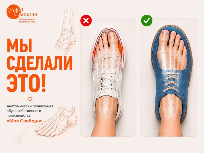 Правильная обувь от подолога!