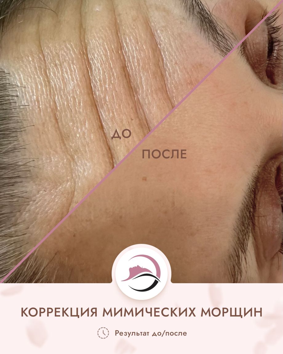 Только Ты
