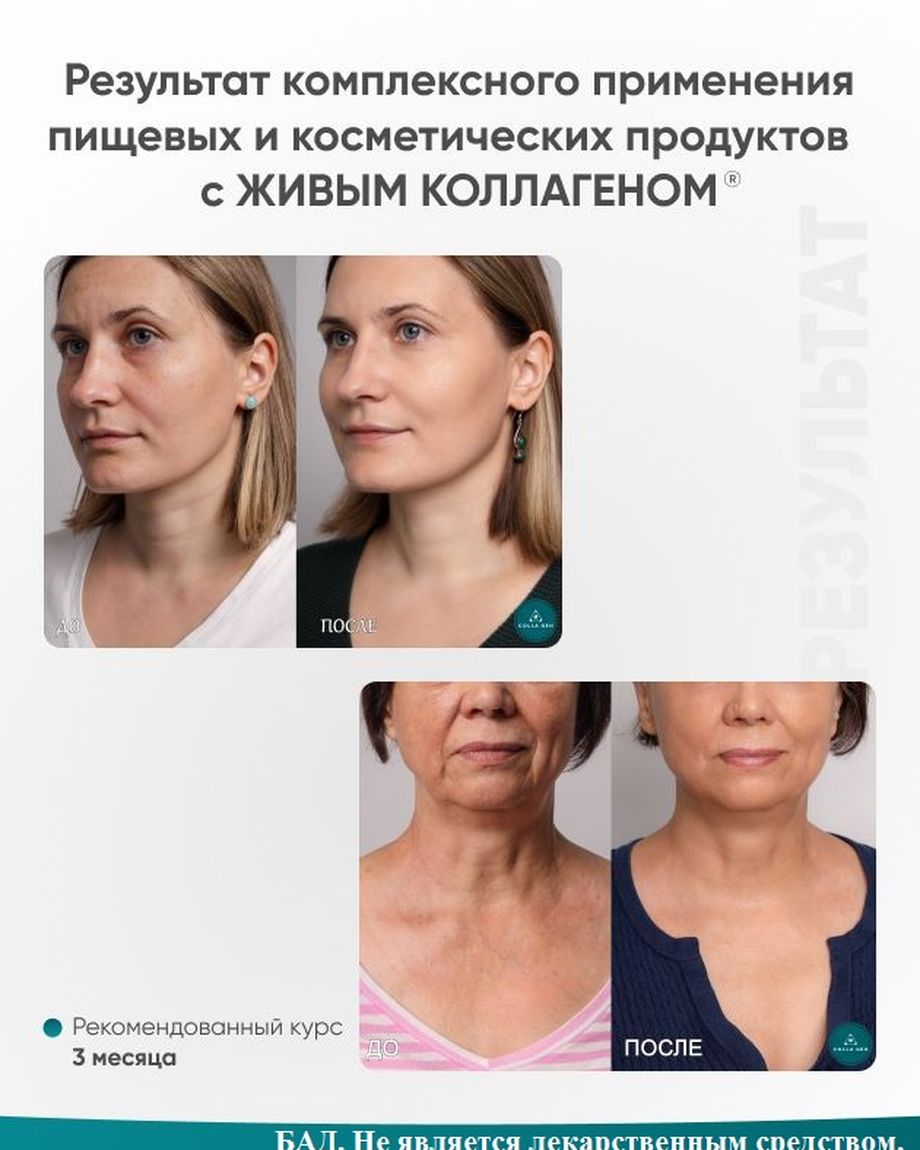 ПЕРВЫЙ ЖИВОЙ КОЛЛАГЕН. ПРОИЗВОДИТЕЛЬ