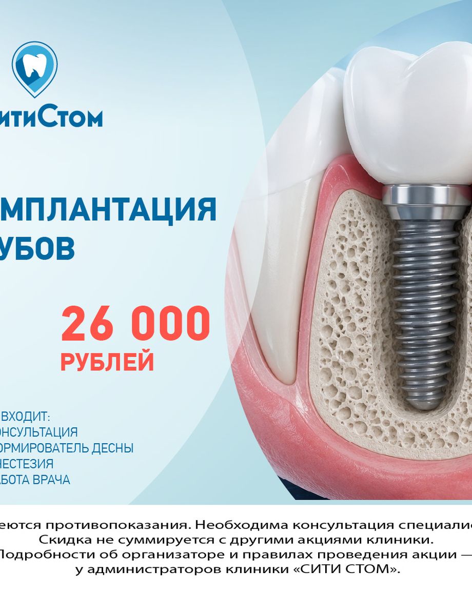СитиСтом