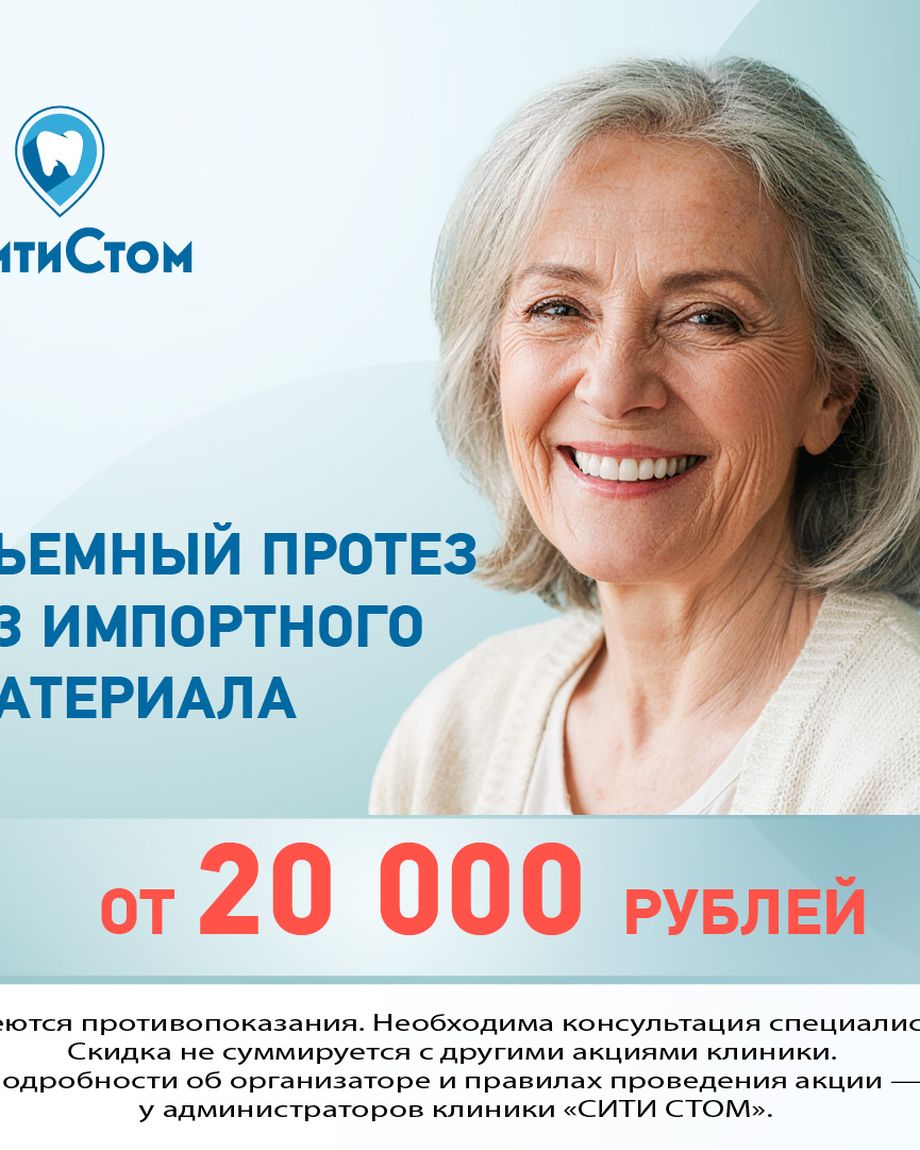 СитиСтом