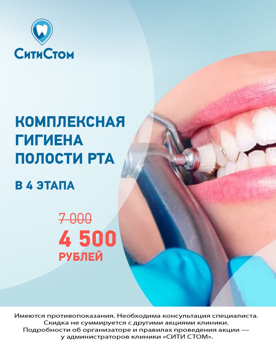 СитиСтом