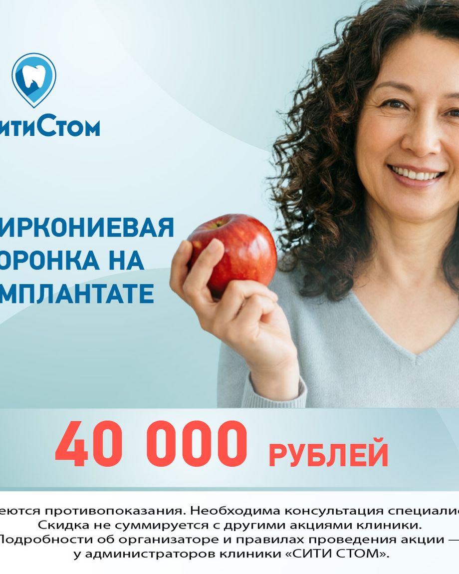 СитиСтом