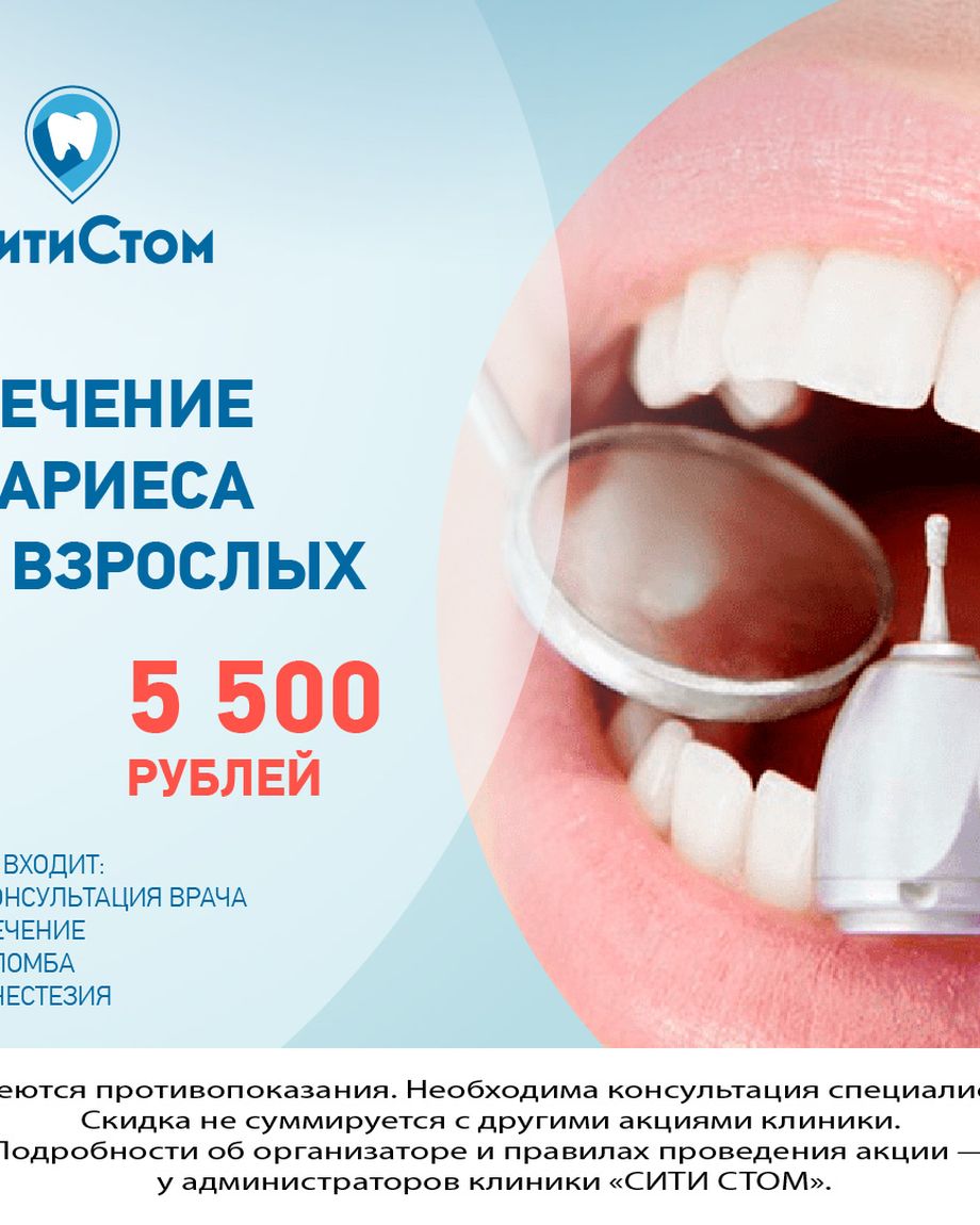 СитиСтом