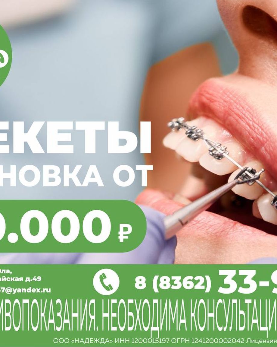 Скажите А