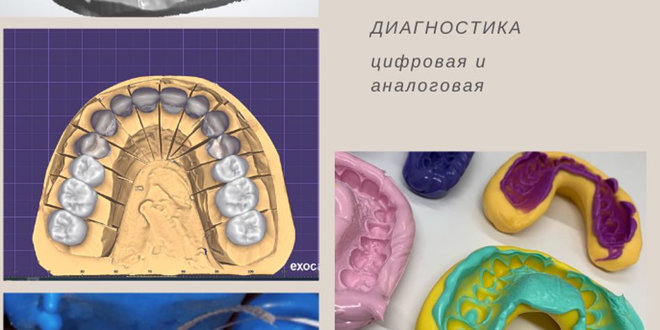 Дента-Люкс