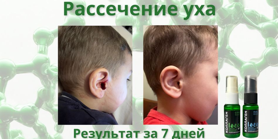 Лекол