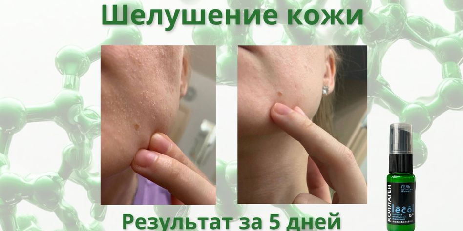 Лекол