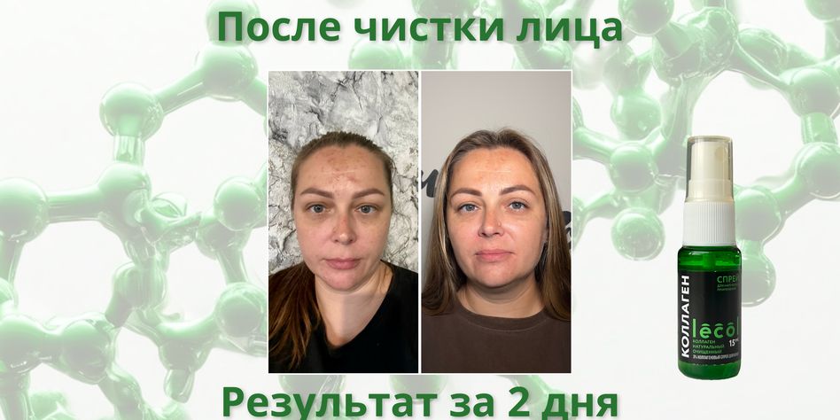 Лекол