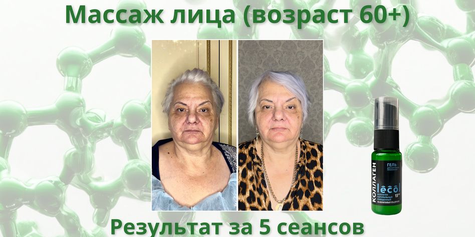 Лекол